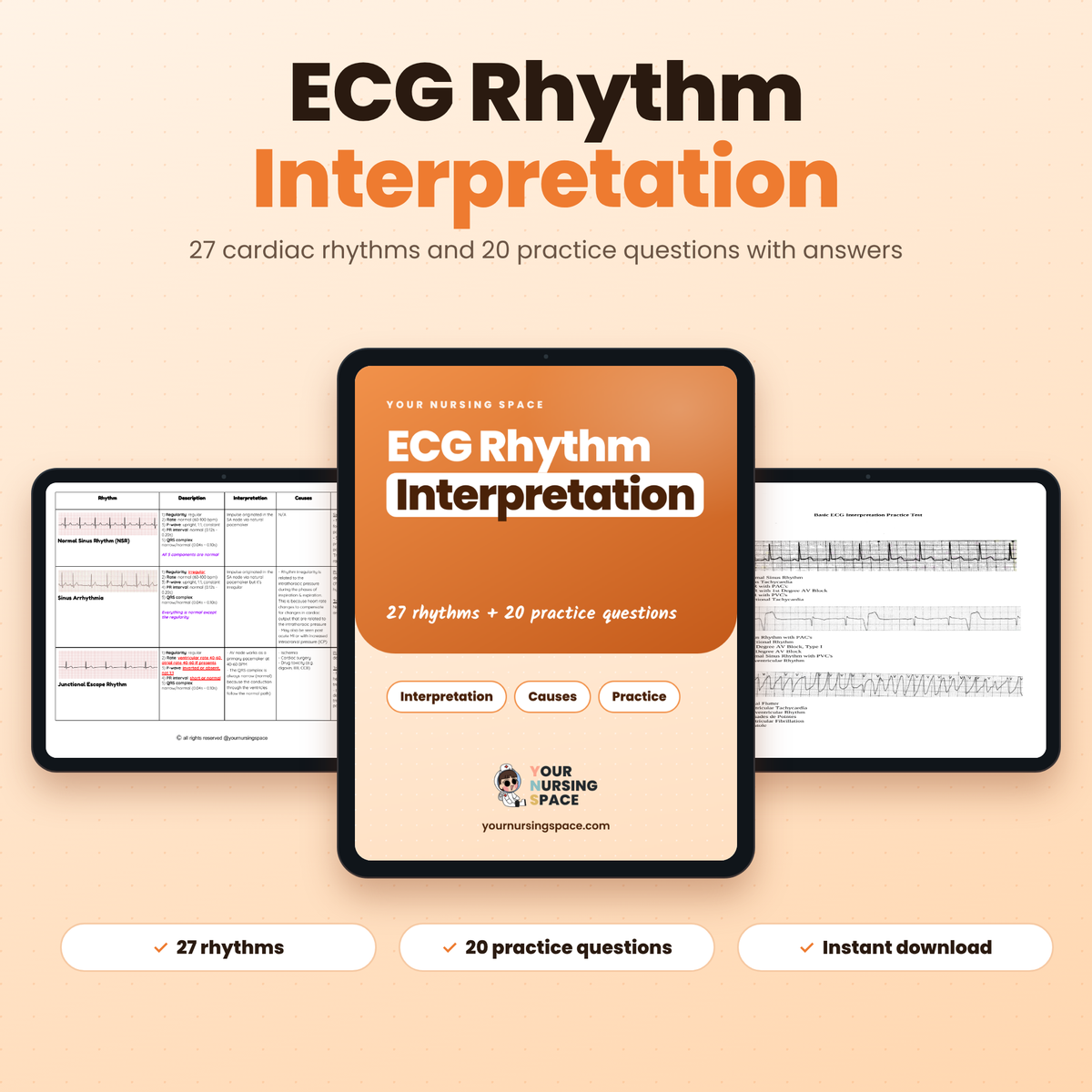 ECG and dysrhythmia interpretation study guide PDF for nurses